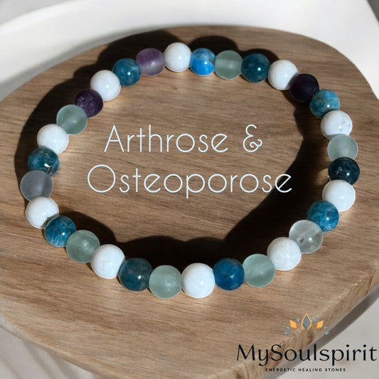 Arthrose – Welcher Heilstein ist der Richtige?